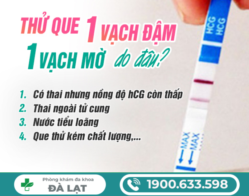 Hình ảnh minh họa